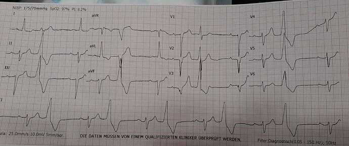EKG.jpg